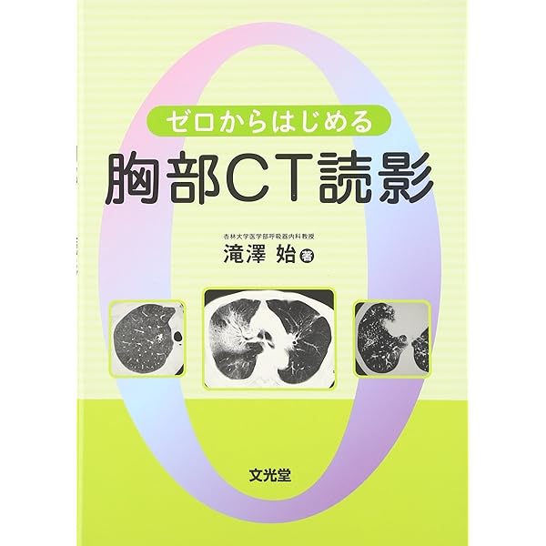 胸部のCT 第4版【裁断済】 裁断済】胸部のCT 第4版